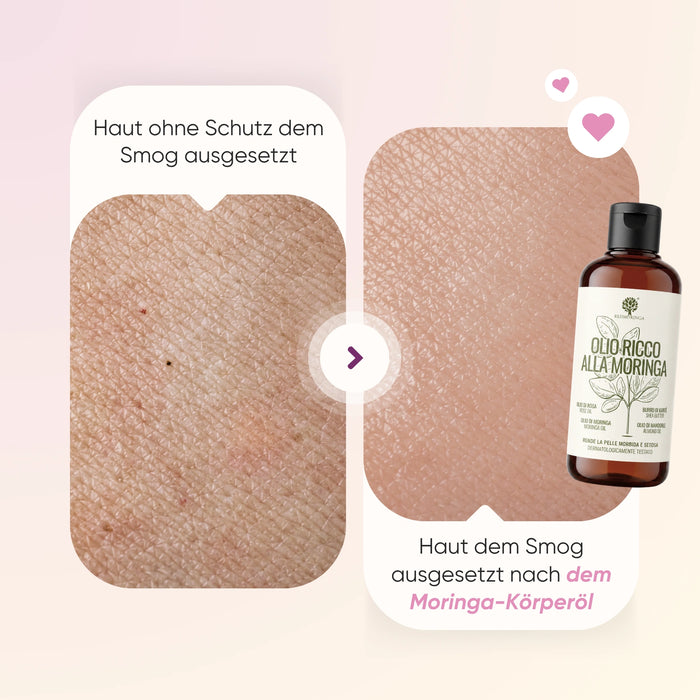 Kit Anticellulite Estate | Integratore Cellulite + Microcircolo + Olio Corpo + Moringlow
